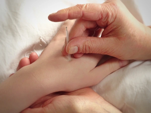 A thin needle is being inserted into a patient’s hand