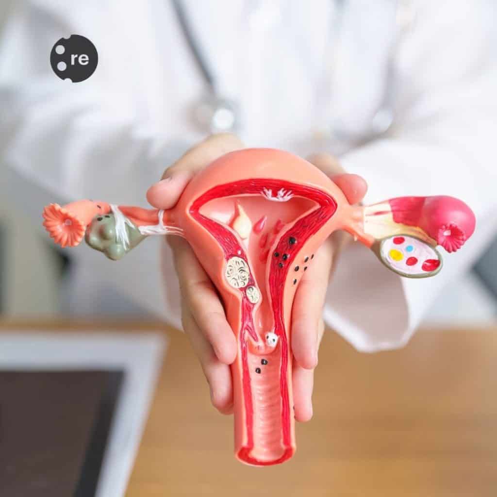 Pelvic Floor Therapy Singapore 4 pevlic floor therapy